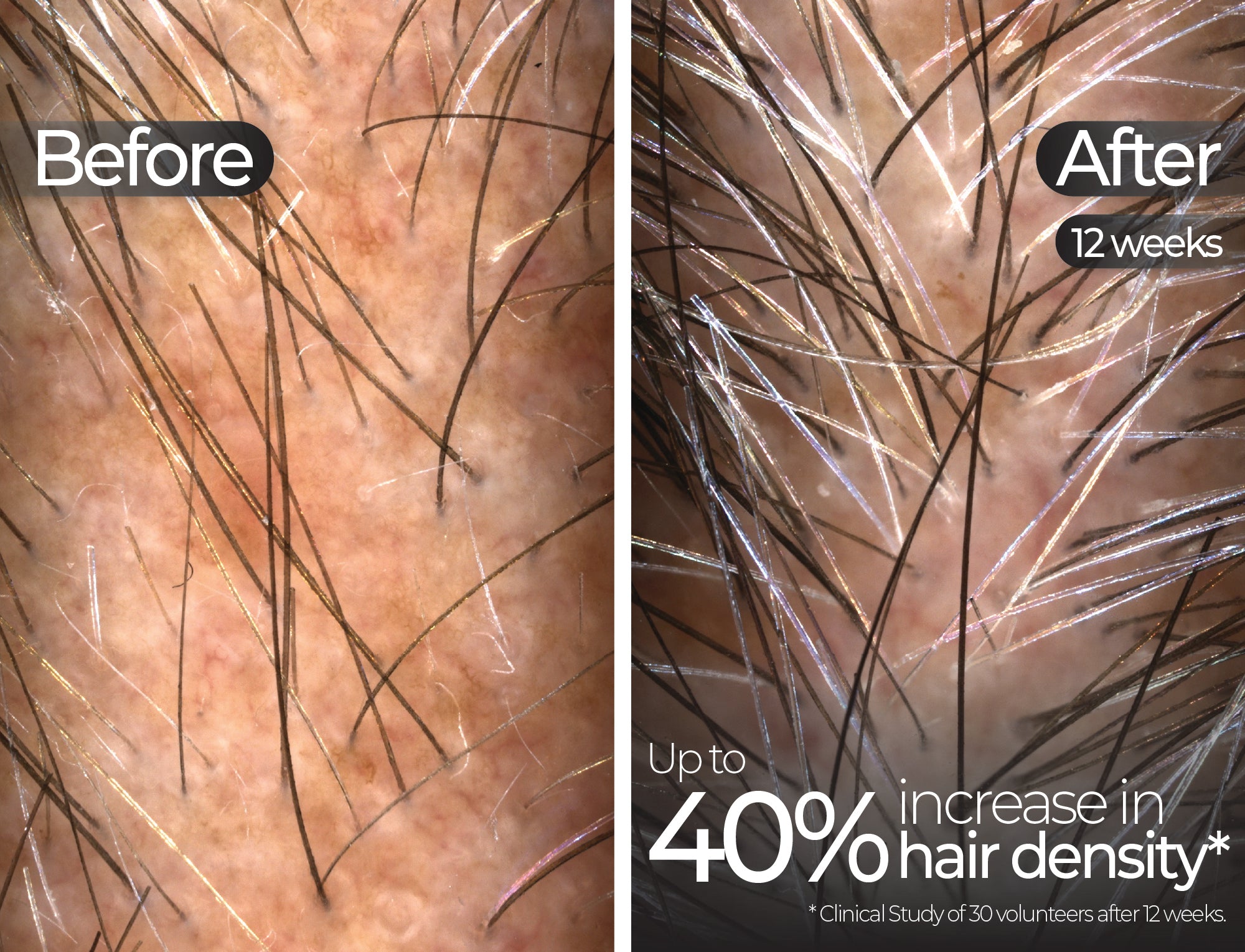 Before & After slide 6