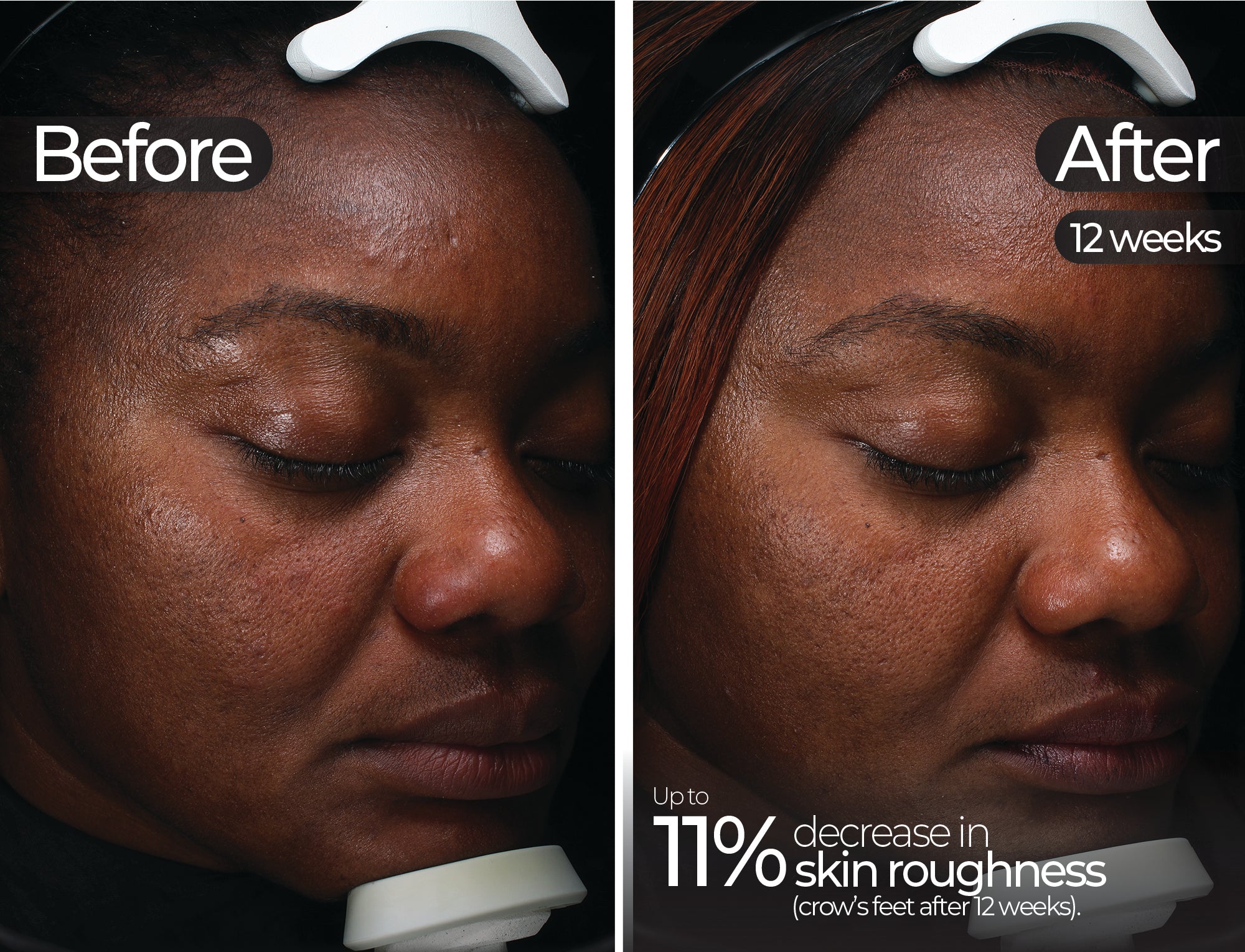 Before & After slide 7