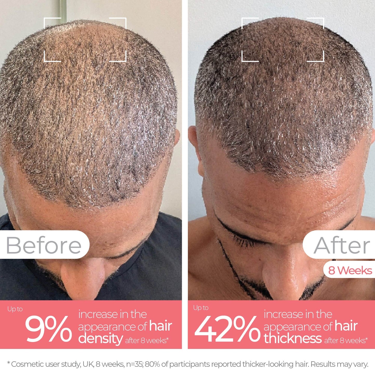 STYLPRO Root Renew Red Light Hairbrush