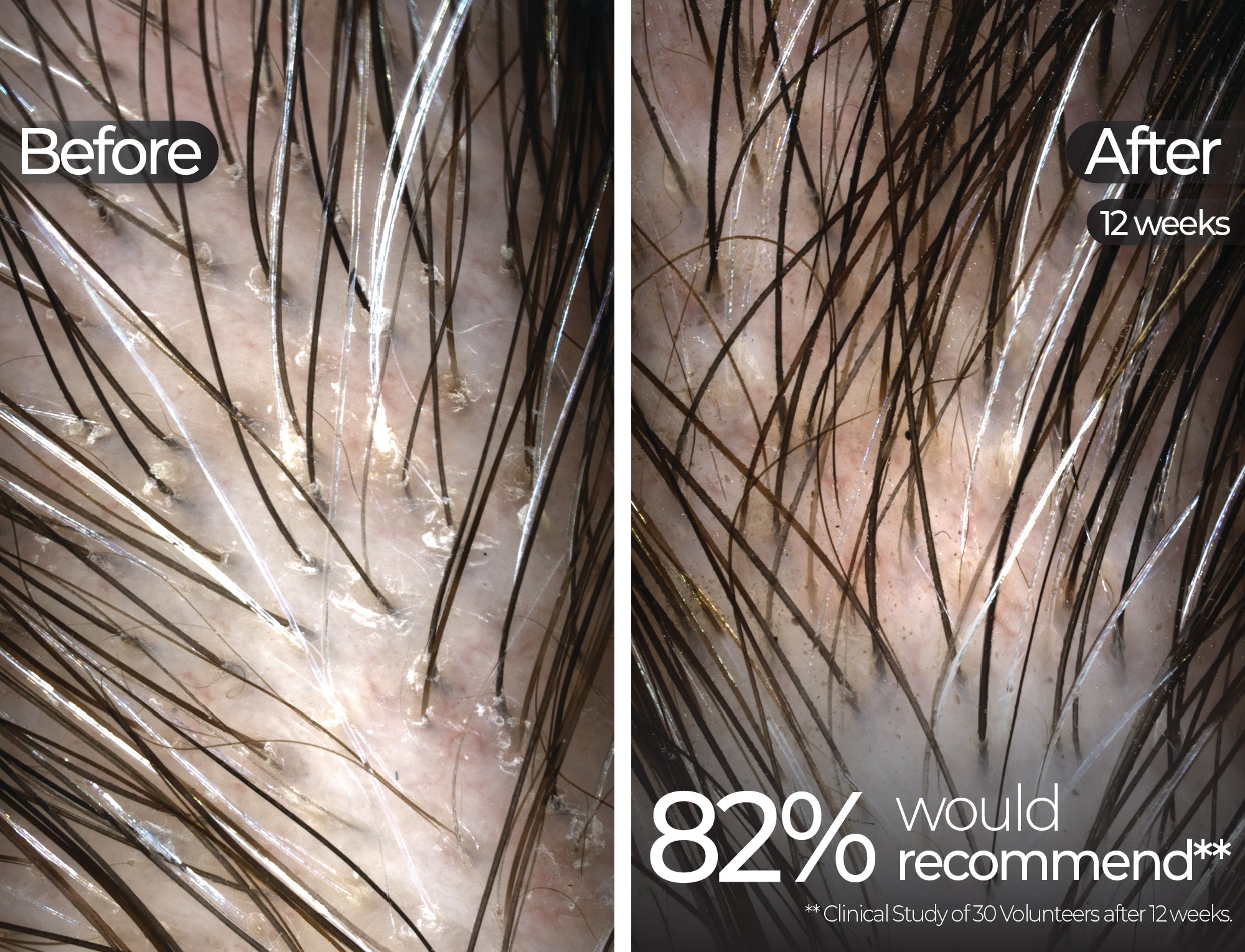 Before & After slide 3