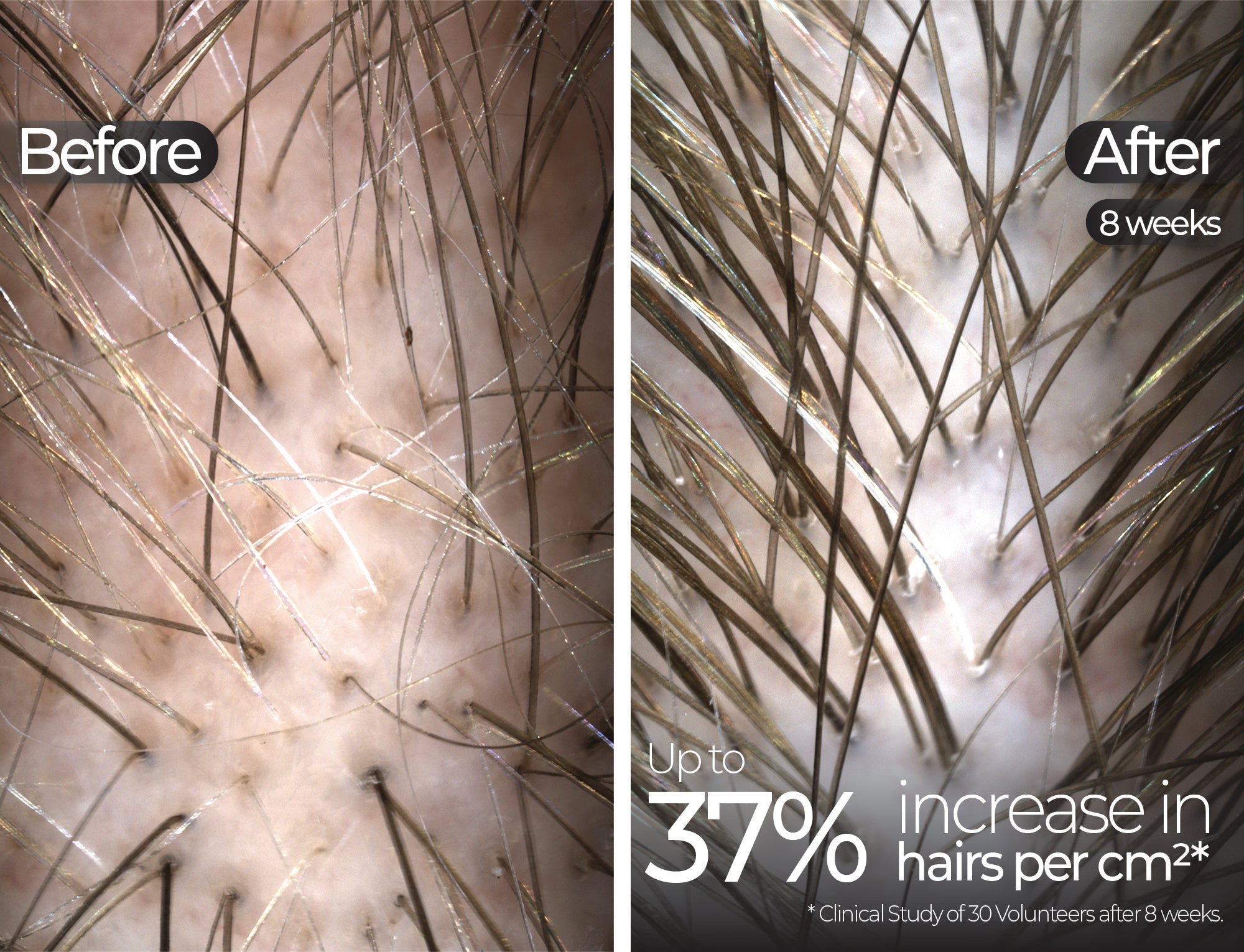 Before & After slide 4